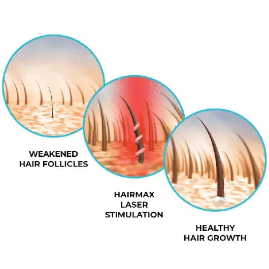 LASER 272 POWERFLEX CAP hairmax.co.uk