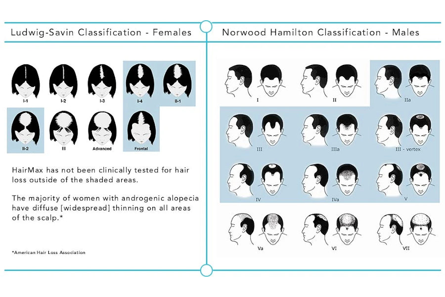 Stages of Hair Loss