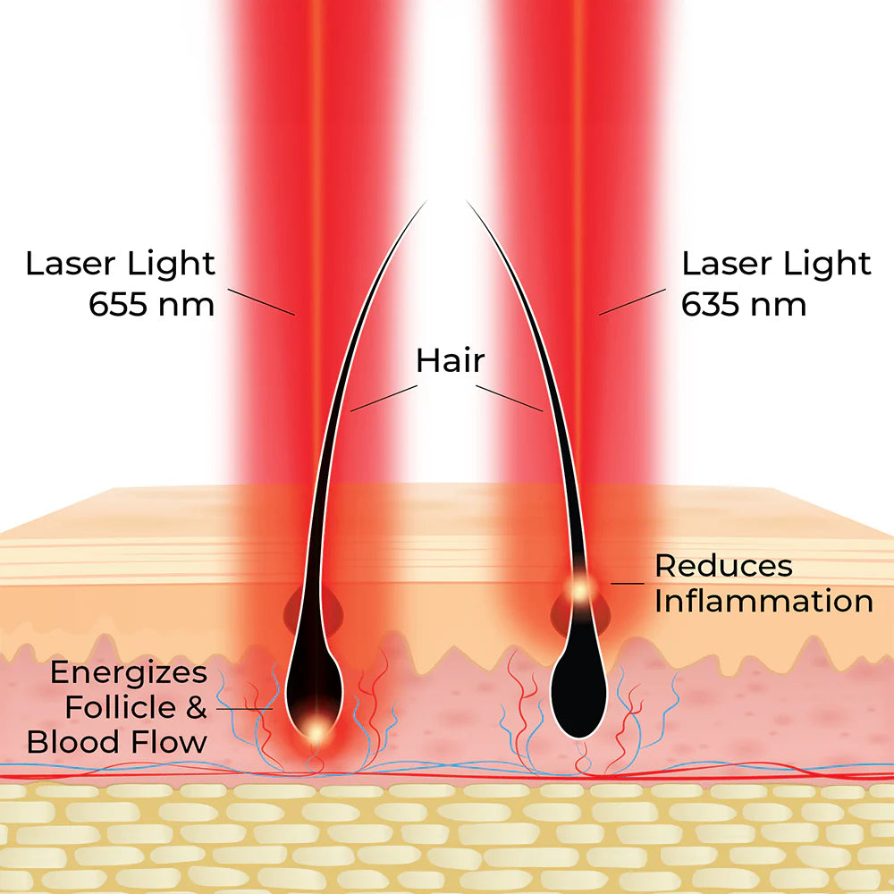 ACTONIS™ 18 DUAL ACTION LASERCOMB (EU) HairMax